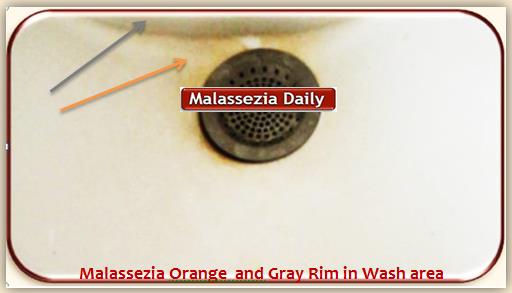 Malassezia in washing area 1-1 MD