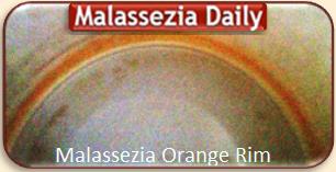 Malassezia Orange Rim