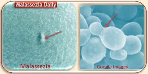 Malassezia images comparison MD