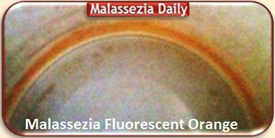 Malassezia Fluorescent 1