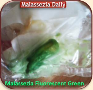 Malassezia Fluorescent Green 2