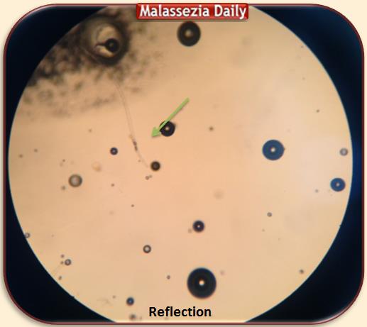 Microscope Reflection 2MD