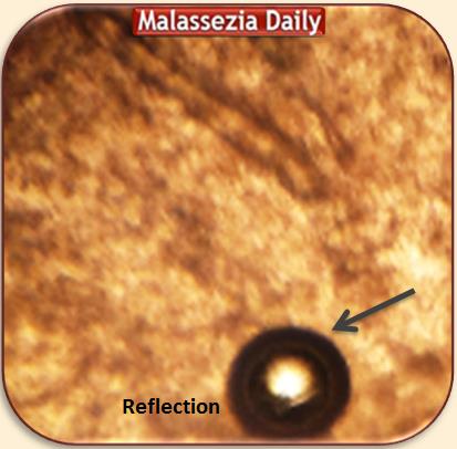 Microscope Reflection MD