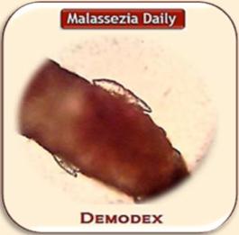 Demodex  MD