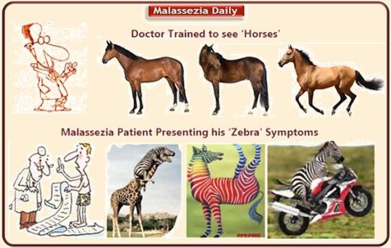 Malassezia and Doctors MD