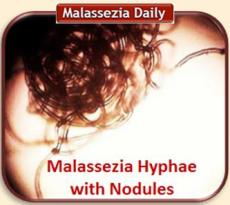 Malassezia Nodulated Hyphae MD