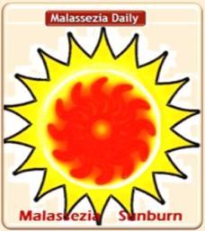 Malassezia Sunburn