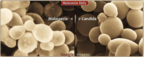 Candida Malassezia comparison MD