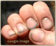 Dirty Nails google image