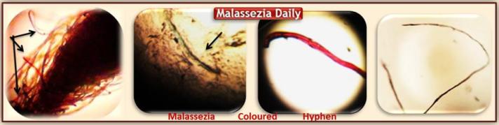 Malasseia Colour Hyphen