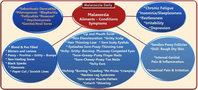 Malassezia Symptoms MD